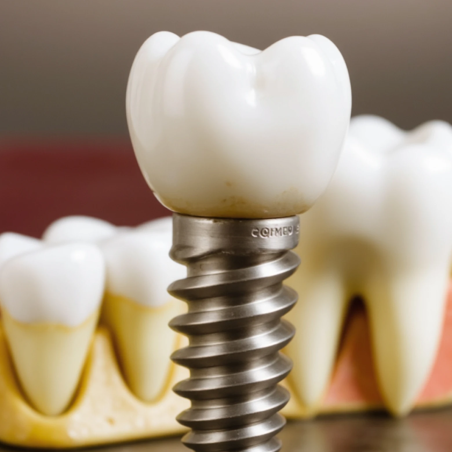 Illustration for Medical Implants